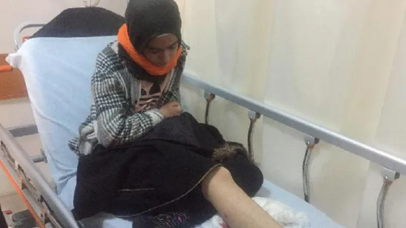 Okula giderken sokak köpeklerinin saldırısına uğrayan Hayrunnisa yaralandı
