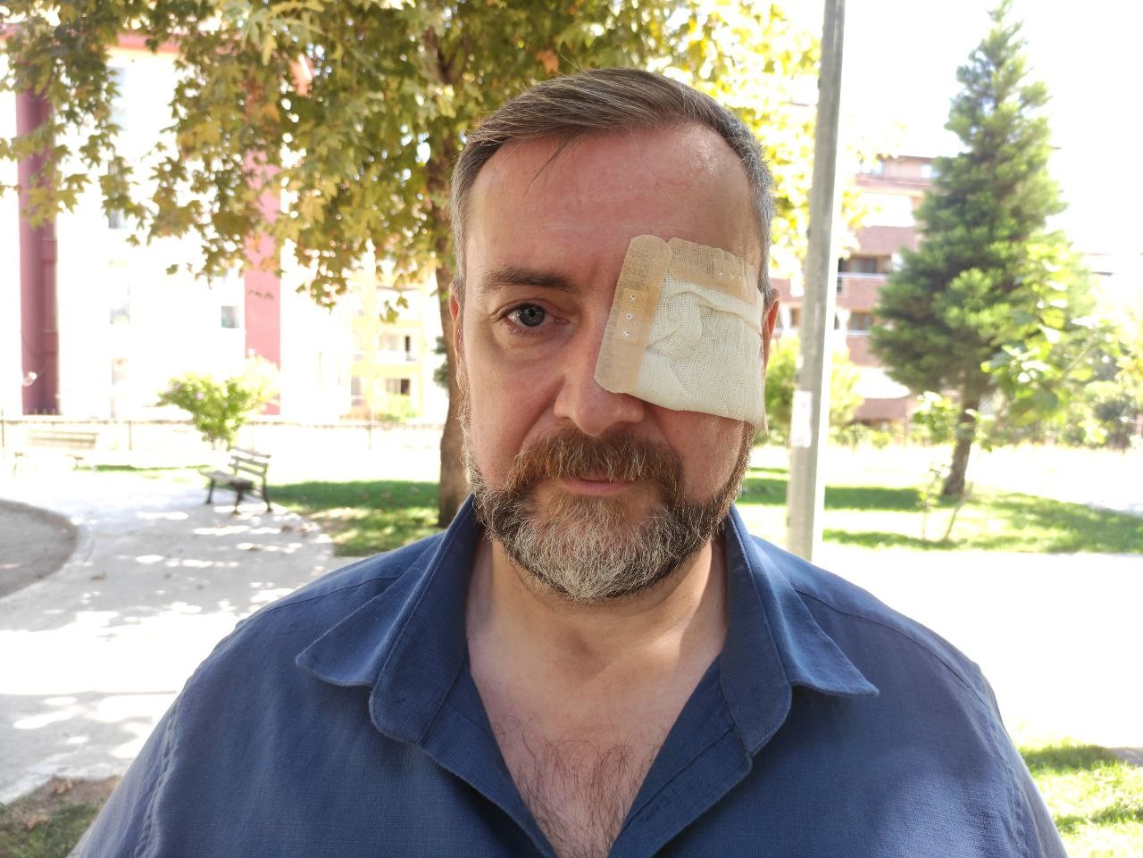 Tarihi geçmiş döner satmayı reddeden şef hem gözünden hem de işinden oldu