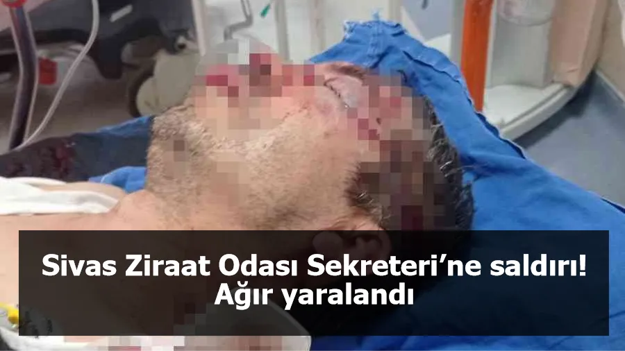 Sivas Ziraat Odası Sekreteri’ne saldırı! Ağır yaralandı