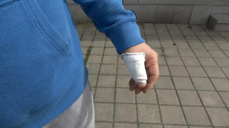 Arnavutköy'de sokak köpekleri çocuklara saldırdı