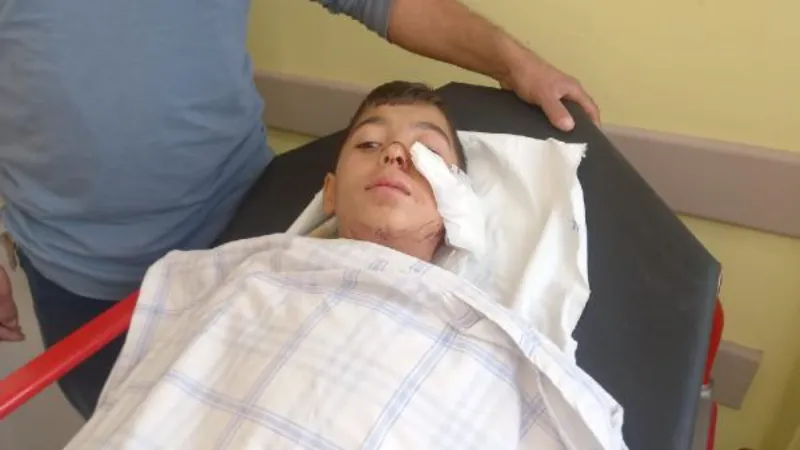 Edirne'de sokak köpeklerinin saldırdığı 12 yaşındaki Umut, ağır yaralandı