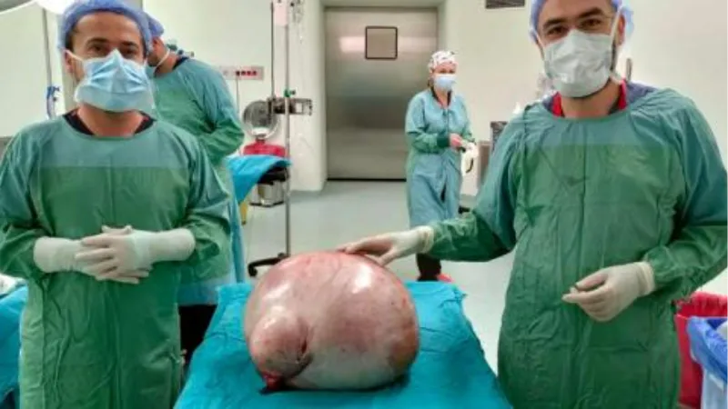 Hastanın karnından 35 kiloluk kitle çıkarıldı