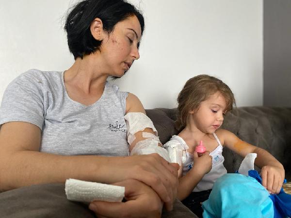 Restoran çıkışı köpek saldırısına uğrayan anne- kız yaralandı