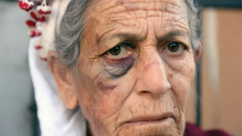 72 yaşındaki kanser hastası kadını bayıltana kadar dövüp, para ve altınlarını aldı