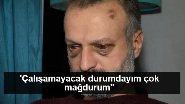 İstek parçayı çalmadığı için dövülen müzisyen: 'Çalışamayacak durumdayım çok mağdurum"