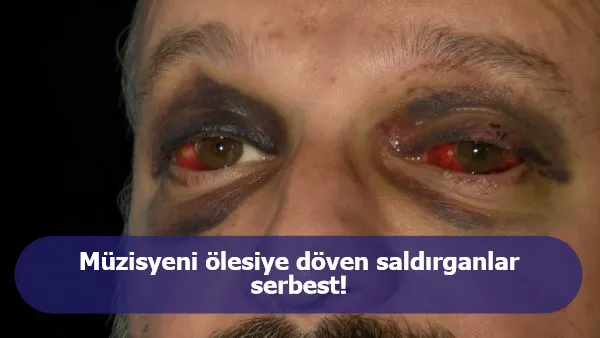 Müzisyeni ölesiye döven saldırganlar serbest!