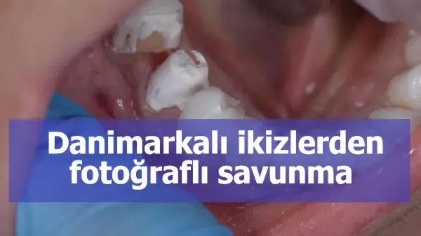  Danimarkalı ikizlerden fotoğraflı savunma